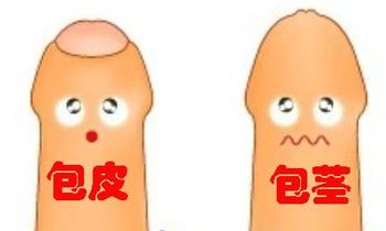包茎会对患者造成哪些影响