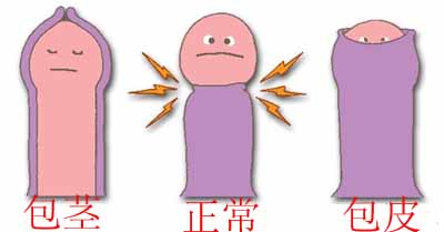 男性包茎的危害有哪些